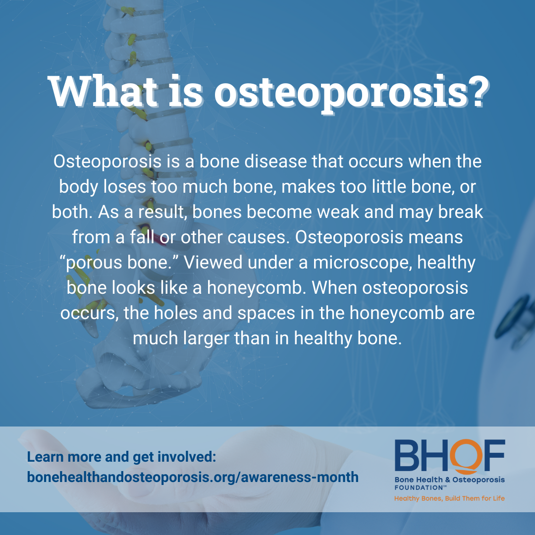 Social Post 4 - Bone Health & Osteoporosis Foundation